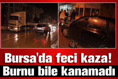 Bursa'da feci kaza! Burnu bile kanamadı